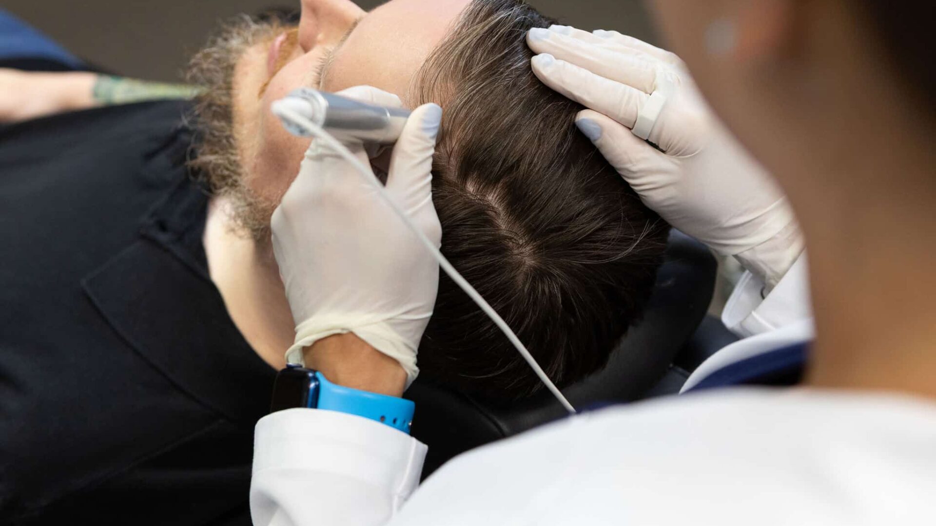 Dermatologist performing scalp examination with needle and gloves